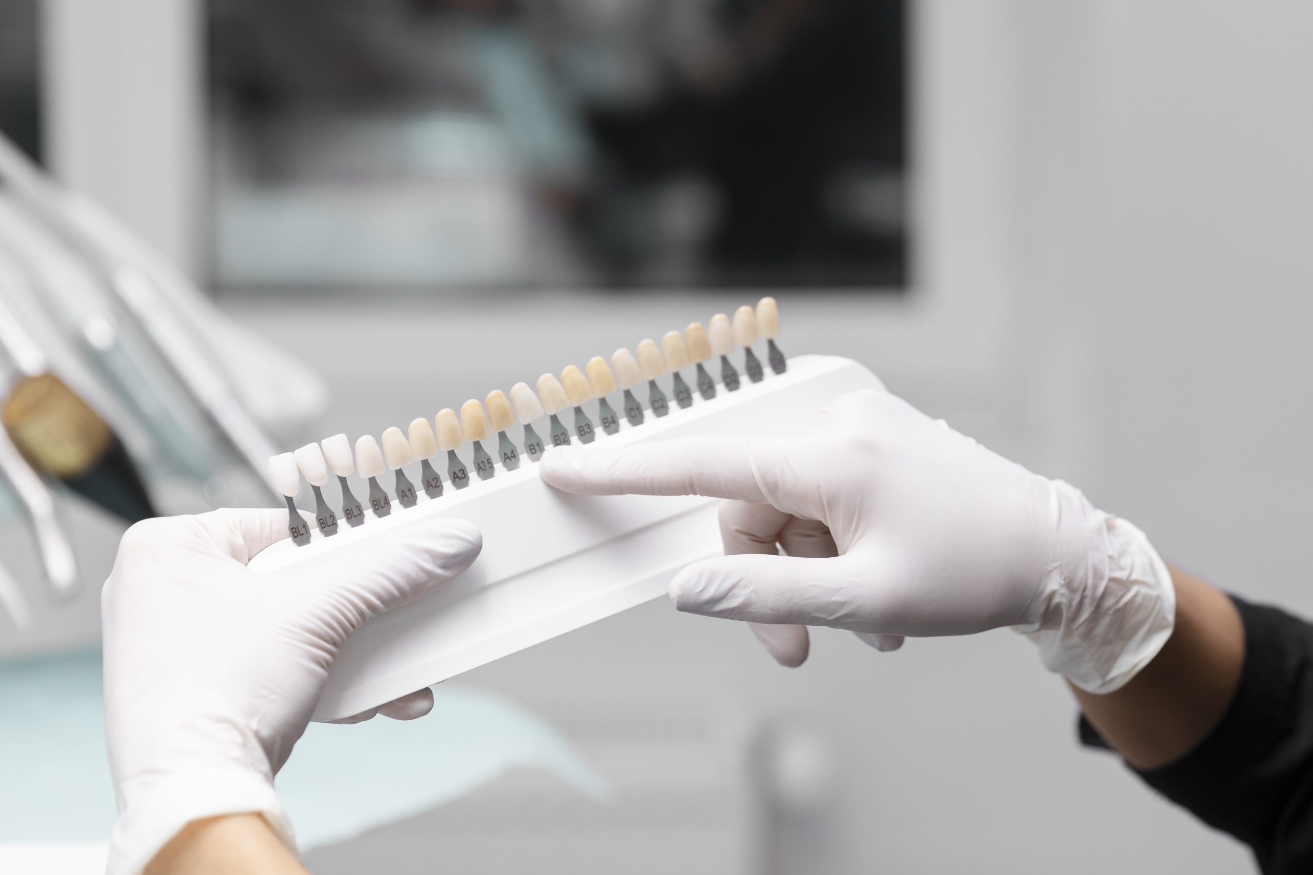 What I Wish I Knew Before Veneers: What to Expect During and After Treatment