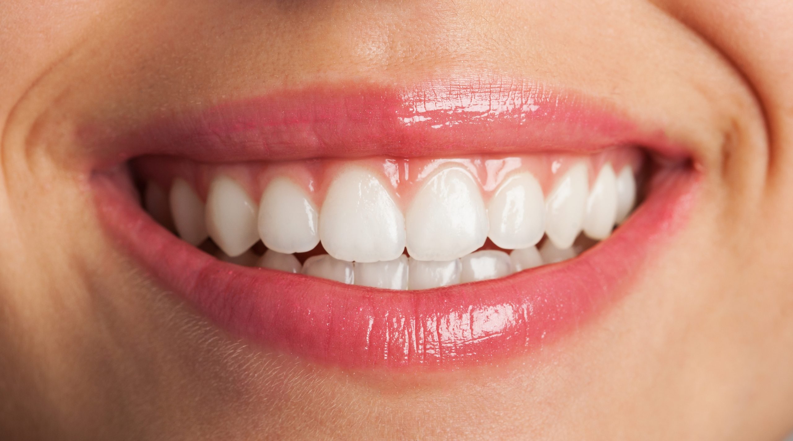 Do Veneers Affect Your Speech? What to Know Before Treatment