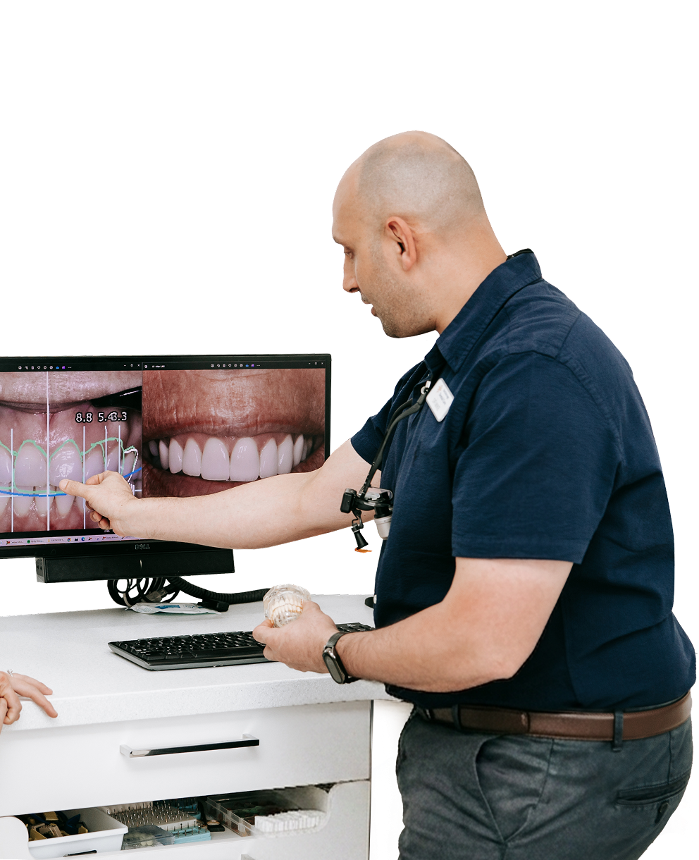 Porcelain Veneers