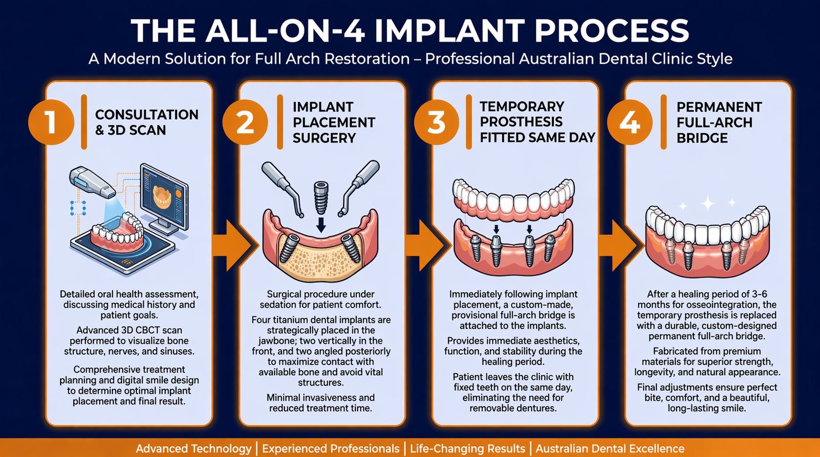 Infographic showing The All-on-4 Implant Process: 4 steps including consultation and 3D scan, implant placement surgery, temporary prosthesis fitted same day, and permanent full-arch bridge